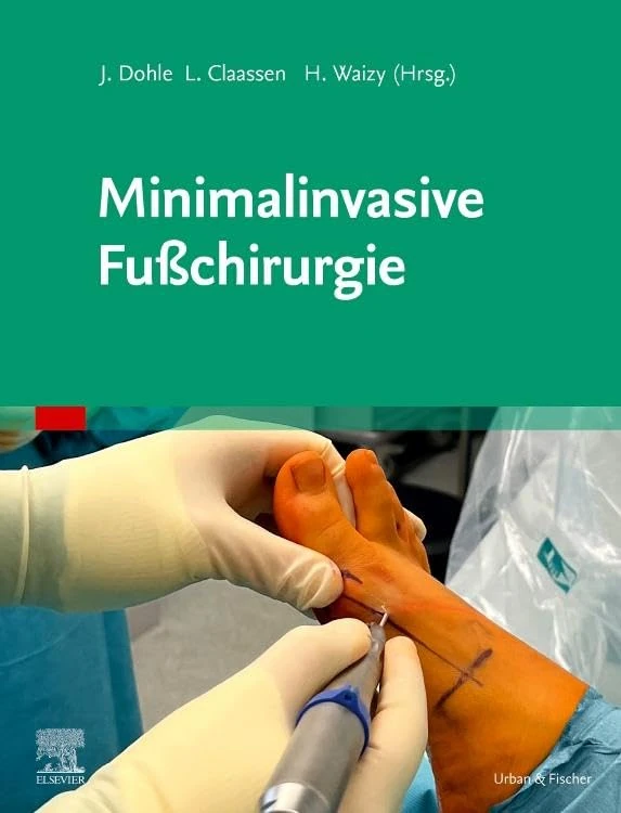 Minimalinvasive Fußchirurgie (MONOGRAPHIE - Fachbuch - Urban & Fischer-Verlag)