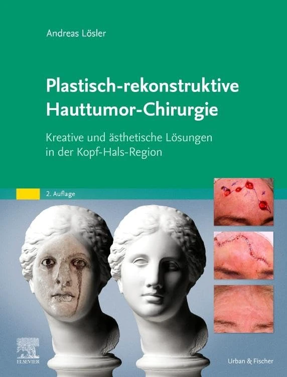 Plastisch-rekonstruktive Hauttumor-Chirurgie: Kreative und ästhetische Lösungen in der Kopf-Hals-Region (MONOGRAPHIE - Fachbuch - Urban & Fischer-Verlag)
