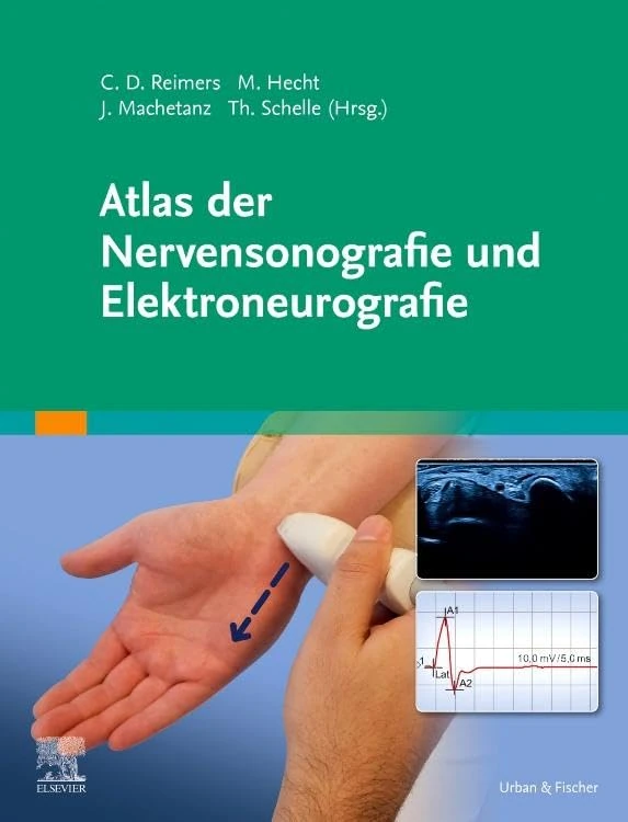 Atlas der Nervensonografie und Elektroneurografie (MONOGRAPHIE - Fachbuch - Urban & Fischer-Verlag)