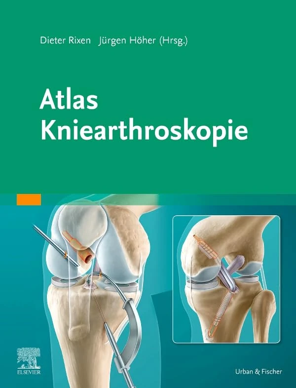 Atlas Kniearthroskopie: Mit Zugang zur Medizinwelt (MONOGRAPHIE - Fachbuch - Urban & Fischer-Verlag)