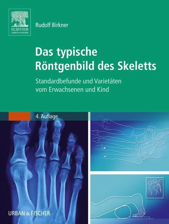 Das typische Röntgenbild des Skeletts: Standardbefunde und Varietäten vom Erwachsenen und Kind (MONOGRAPHIE - Fachbuch - Urban & Fischer-Verlag)