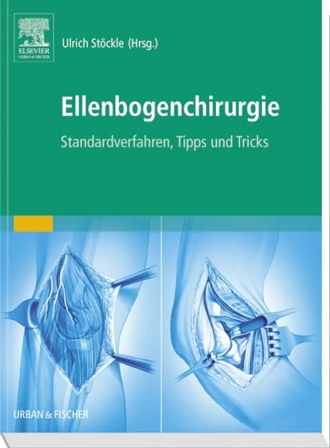Ellenbogenchirurgie: Standardverfahren, Tipps und Tricks: Atlas zu Standardverfahren, Tipps und Tricks (MONOGRAPHIE - Fachbuch - Urban & Fischer-Verlag)