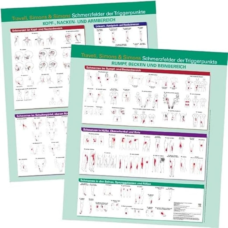 Poster Schmerzfelder Triggerpunkte (KIM - Fachbuch - Urban & Fischer Verlag)