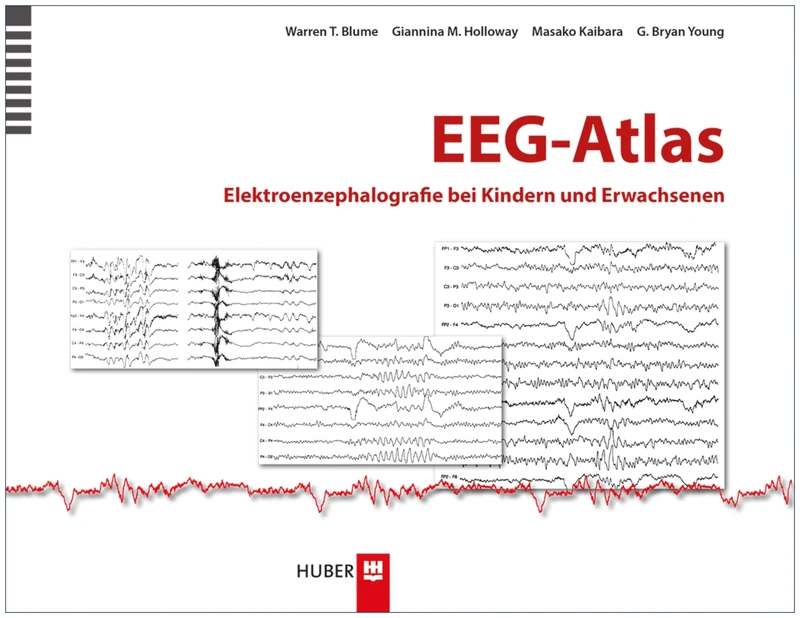 EEG-Atlas: Elektroenzephalografie bei Kindern und Erwachsenen