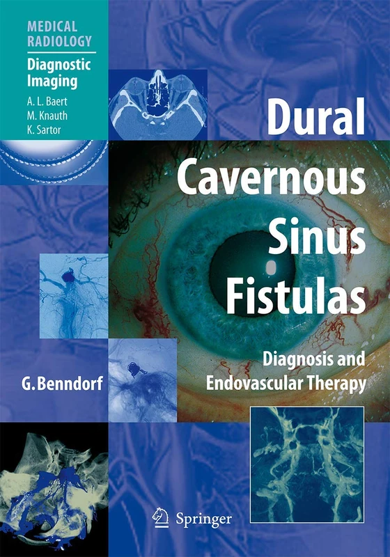 Springer Dural Cavernous Sinus Fistulas Medical Guide - Image 1