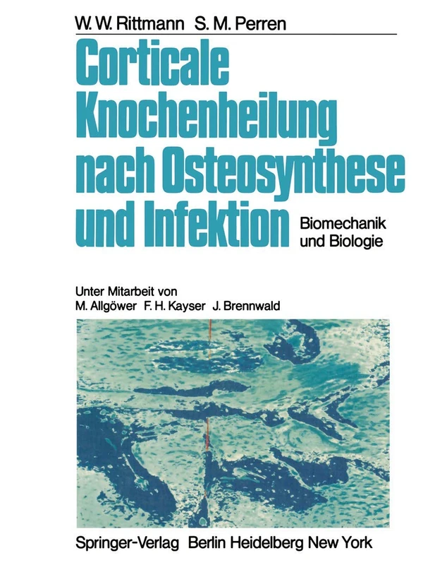 Corticale Knochenheilung nach Osteosynthese und Infektion: Biomechanik und Biologie