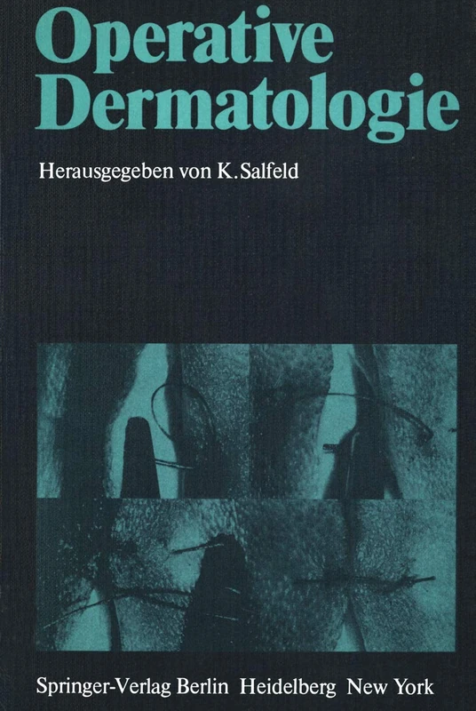 Operative Dermatologie: Vorträge des 2. Symposiums für Dermatochirurgie, Minden ― Bad Salzuflen, 26. bis 28. Mai 1978