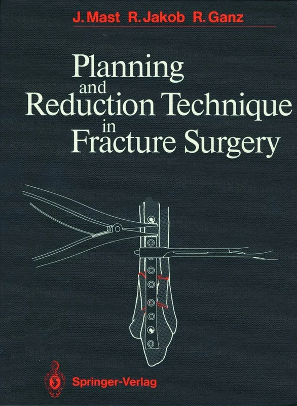 Planning and Reduction Technique in Fracture Surgery