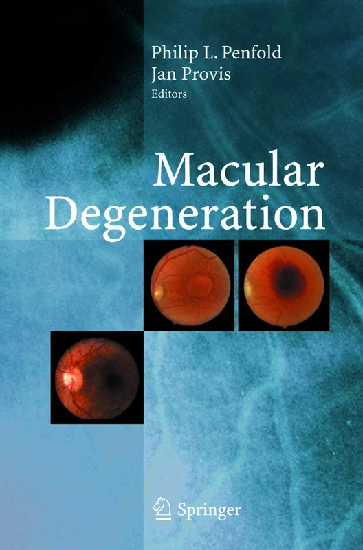 Springer Macular Degeneration - Science and Medicine in Practice - Image 1