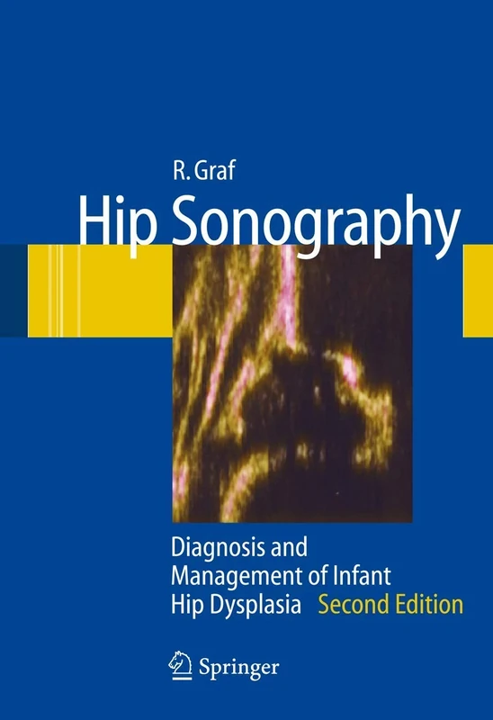 Hip Sonography: Diagnosis and Management of Infant Hip Dysplasia - Image 1