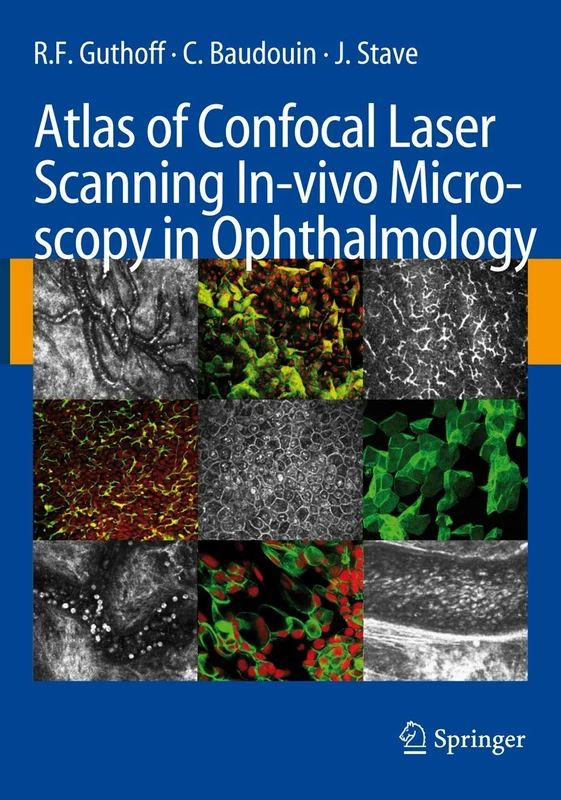 Springer Atlas of Confocal Laser Scanning In-vivo Microscopy