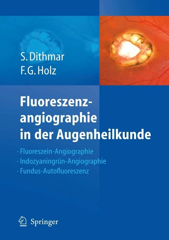 Springer Fluoreszenzangiographie in der Augenheilkunde Atlas