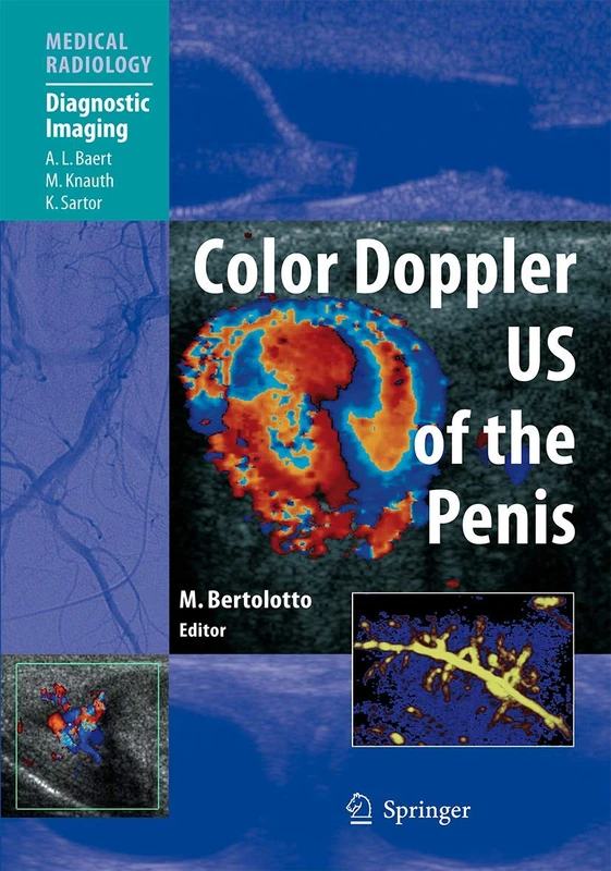 Springer Color Doppler US of the Penis - Medical Radiology Book