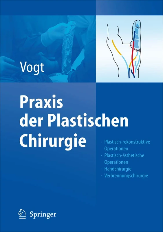 Springer Praxis der Plastischen Chirurgie - Medical Textbook