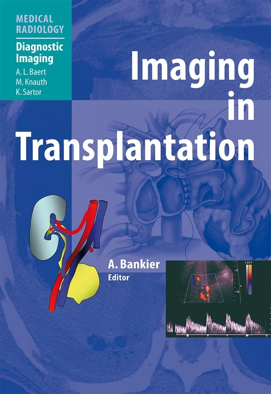 Imaging in Transplantation (Medical Radiology)