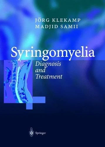 Syringomyelia: Diagnosis and Treatment - Image 1