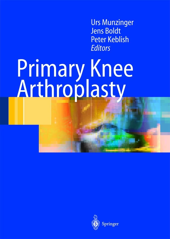 Primary Knee Arthroplasty: From Basic Science of Clinical Evidence