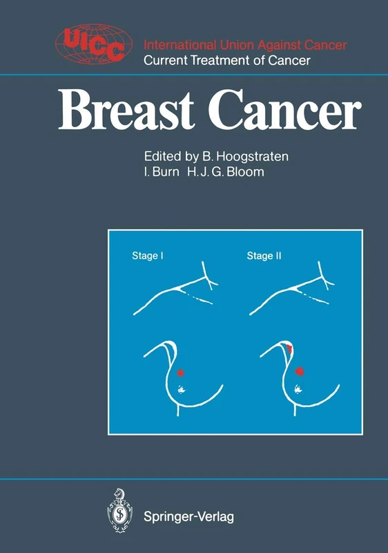 Breast Cancer (UICC Current Treatment of Cancer)