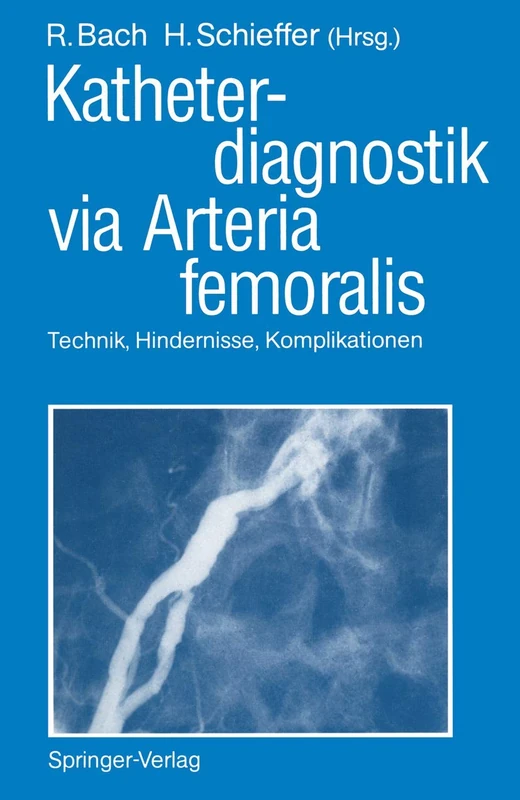 Katheterdiagnostik via Arteria femoralis: Technik, Hindernisse, Komplikationen