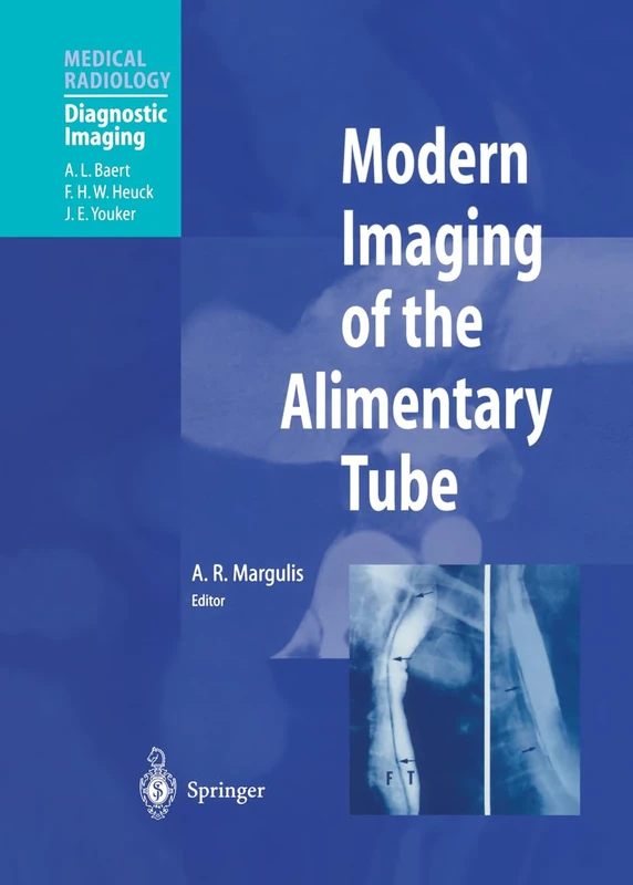 Modern Imaging of the Alimentary Tube (Medical Radiology, Diagnostic Imaging and Radiation Oncology)