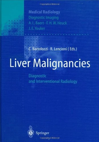 Springer Liver Malignancies - Diagnostic and Interventional Radiology