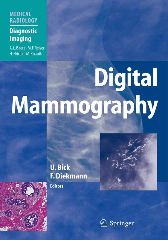 Springer Digital Mammography - Medical Radiology Textbook
