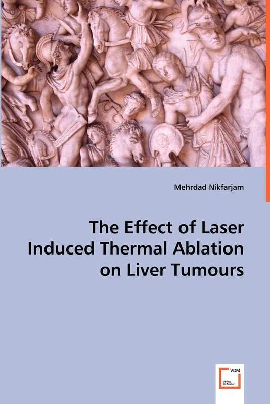 The Effect of Laser Induced Thermal Ablation on Liver Tumours