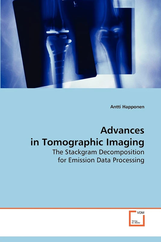 Advances in Tomographic Imaging