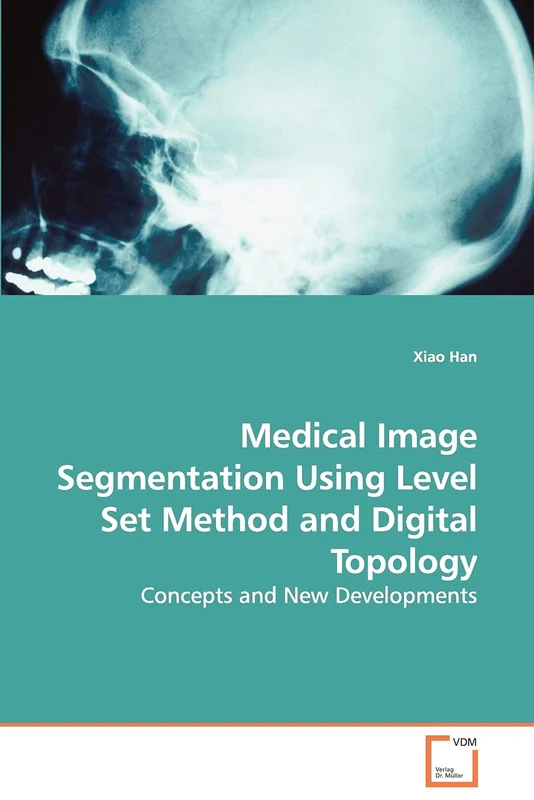 Medical Image Segmentation Using Level Set Method and Digital Topology: Concepts and New Developments