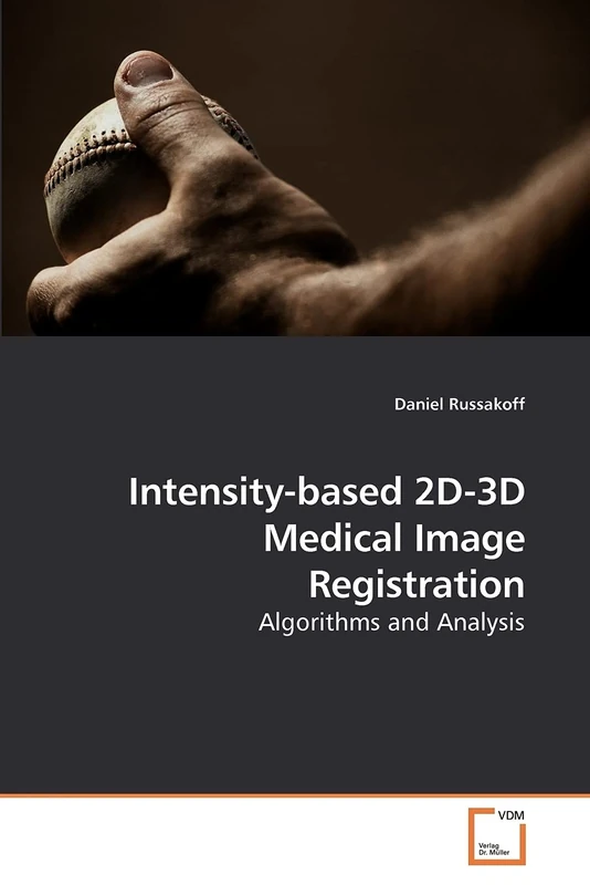 Intensity-based 2D-3D Medical Image Registration: Algorithms and Analysis