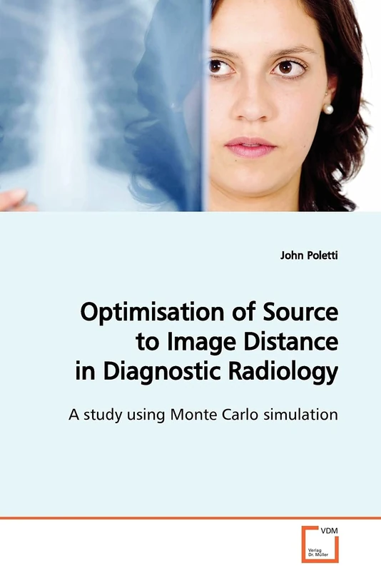 Optimisation of Source to Image Distance in Diagnostic Radiology: A study using Monte Carlo simulation