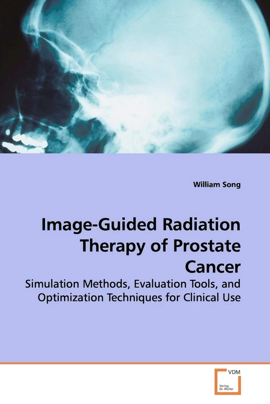 Image-Guided Radiation Therapy of Prostate Cancer: Simulation Methods, Evaluation Tools, and Optimization Techniques for Clinical Use