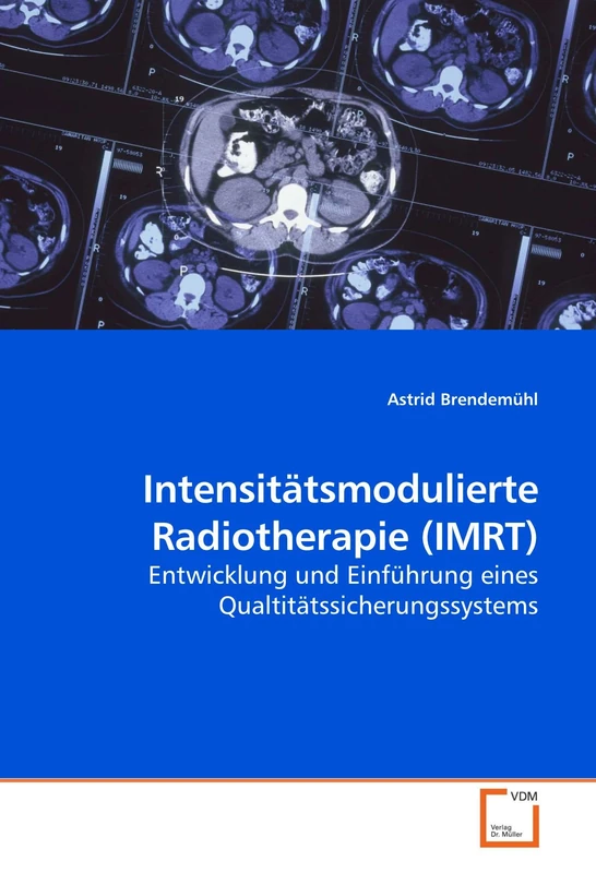 Intensitätsmodulierte Radiotherapie (IMRT): Entwicklung und Einführung eines Qualtitätssicherungssystems