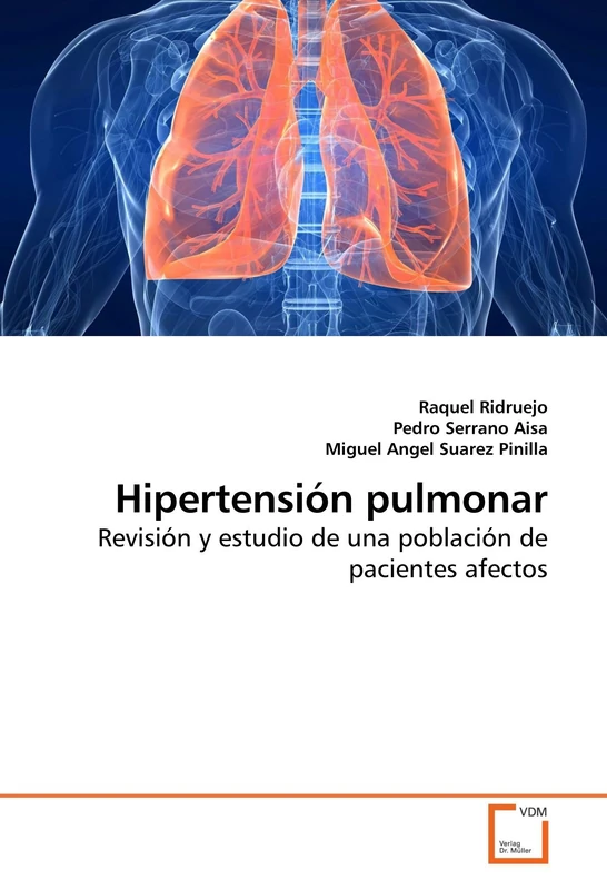 Hipertensión pulmonar: Revisión y estudio de una población de pacientes afectos - Image 1