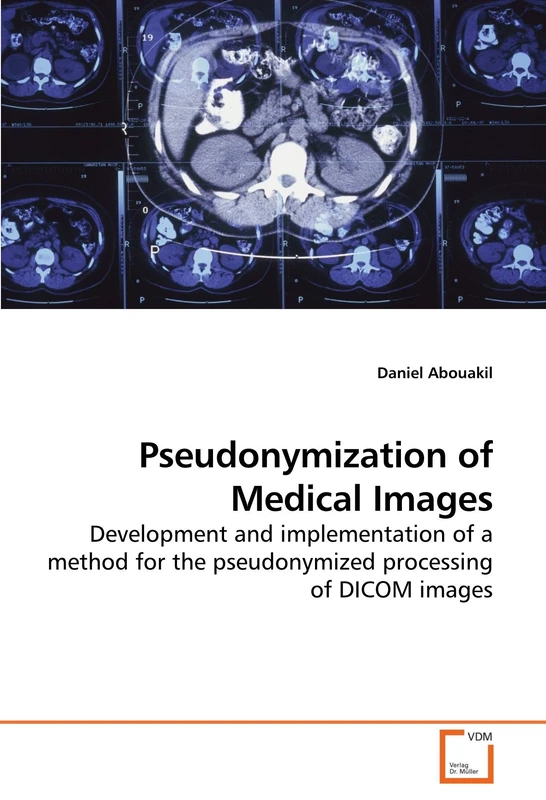Pseudonymization of Medical Images: Development and implementation of a method for the pseudonymized processing of DICOM images - Image 1