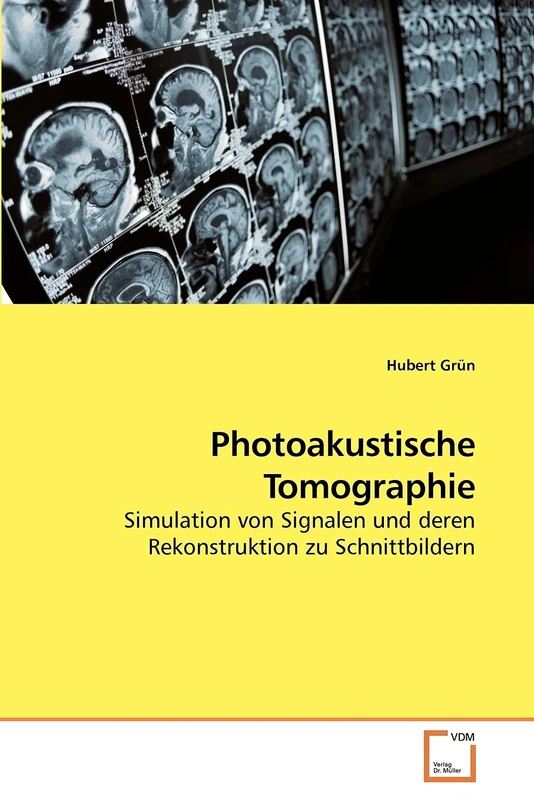 Photoakustische Tomographie: Simulation von Signalen und deren Rekonstruktion zu Schnittbildern