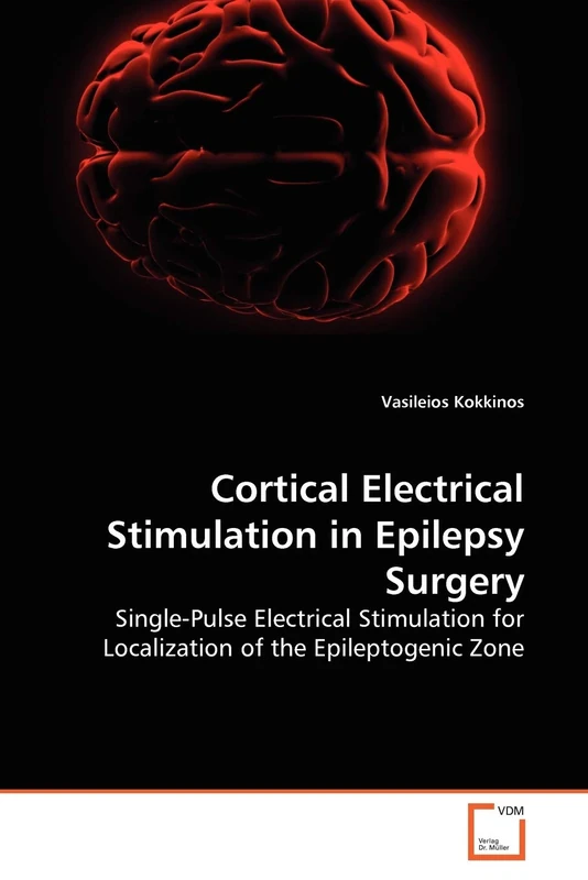Cortical Electrical Stimulation in Epilepsy Surgery: Single-Pulse Electrical Stimulation for Localization of the Epileptogenic Zone