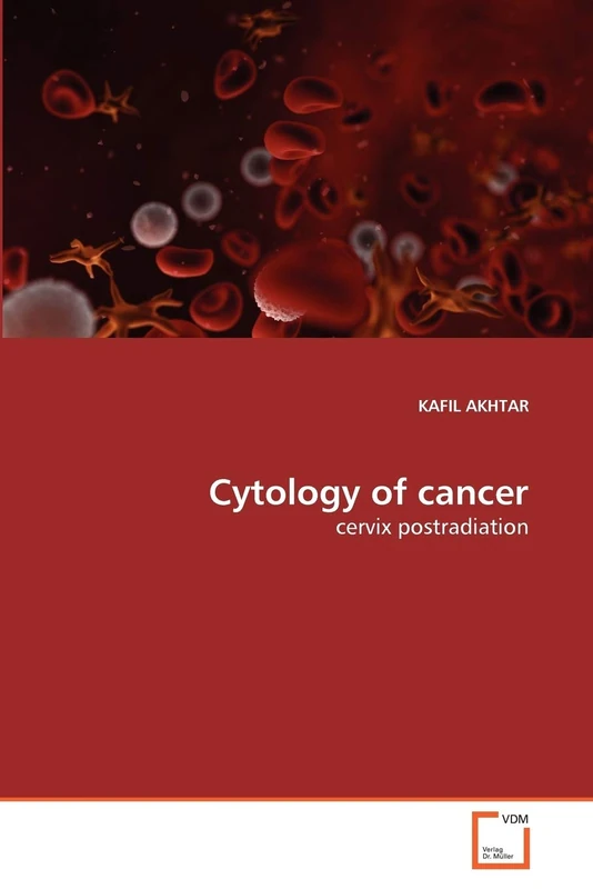 Cytology of cancer: cervix postradiation - Image 1