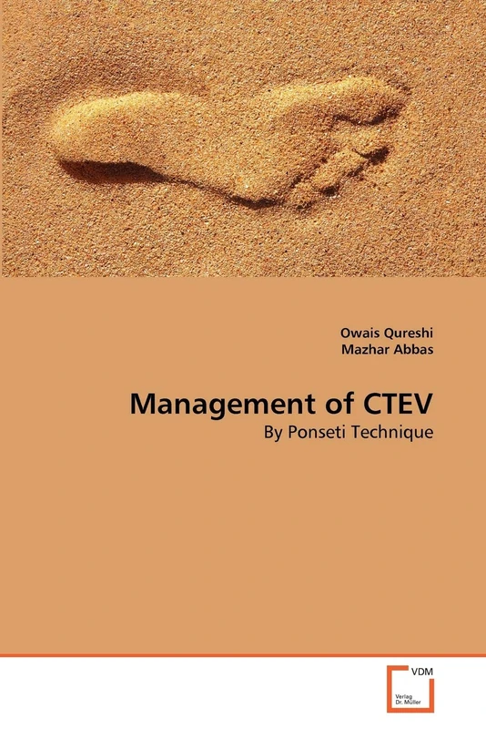 Management of CTEV: By Ponseti Technique