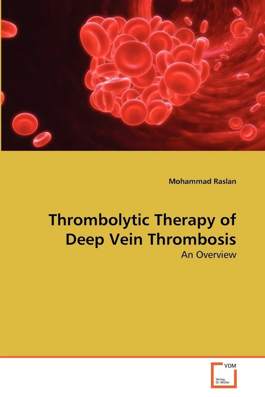 Thrombolytic Therapy of Deep Vein Thrombosis: An Overview - Image 1