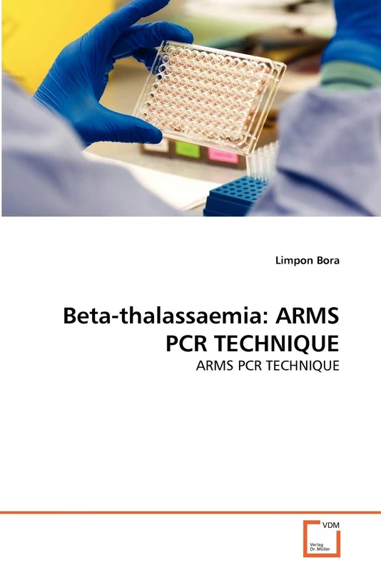 Beta-thalassaemia: ARMS PCR TECHNIQUE: ARMS PCR TECHNIQUE