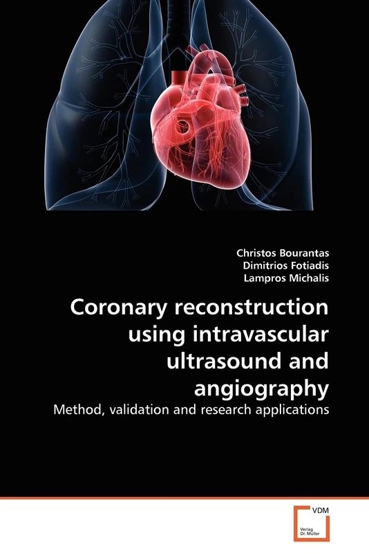 Coronary reconstruction using intravascular ultrasound and angiography: Method, validation and research applications