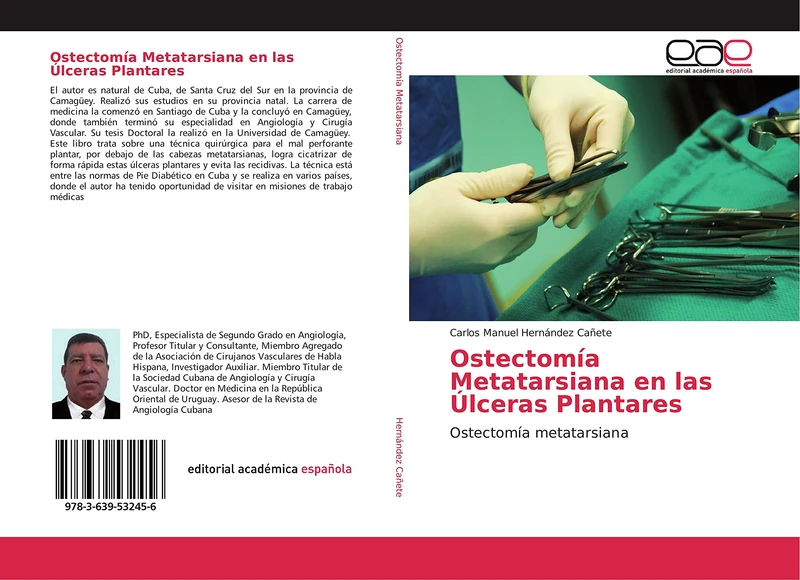 Ostectomía Metatarsiana en las Úlceras Plantares: Ostectomía metatarsiana
