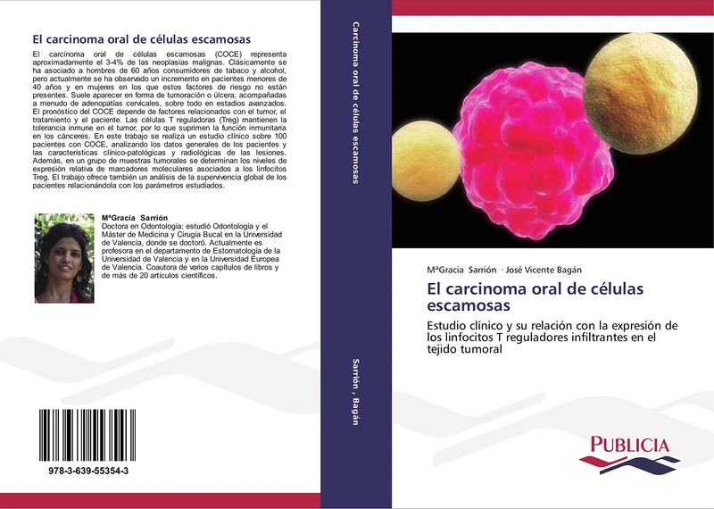El carcinoma oral de células escamosas: Estudio clínico y su relación con la expresión de los linfocitos T reguladores infiltrantes en el tejido tumoral