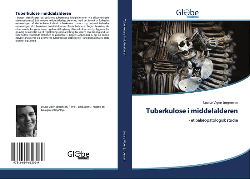 Tuberkulose I Middelalderen: - et palæopatologisk studie - Image 1
