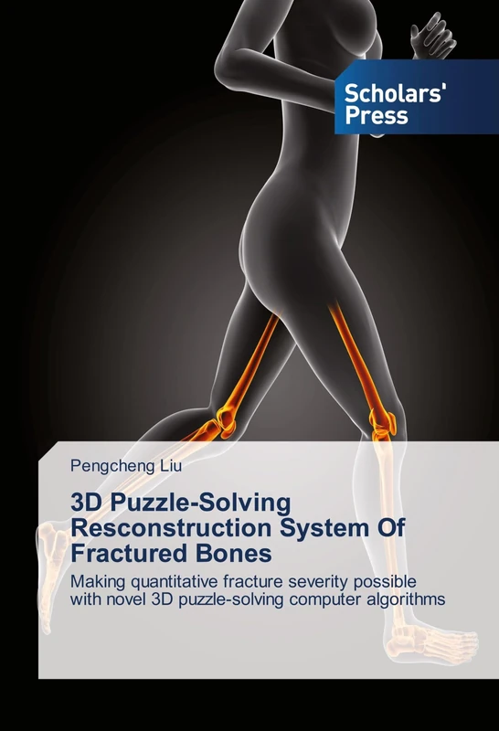3D Puzzle-Solving Resconstruction System Of Fractured Bones: Making quantitative fracture severity possible with novel 3D puzzle-solving computer algorithms