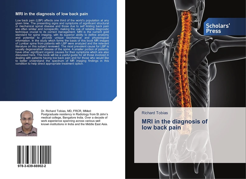 MRI in the diagnosis of low back pain - Image 1