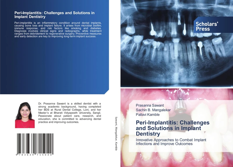 Peri-Implantitis: Challenges and Solutions in Implant Dentistry