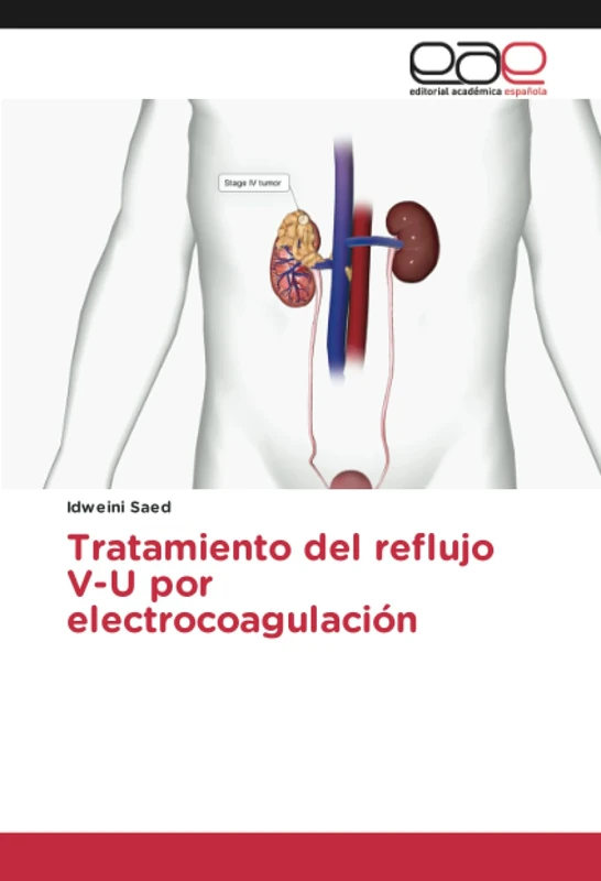 Tratamiento del reflujo V-U por electrocoagulación - Image 1