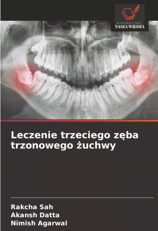 Leczenie trzeciego zęba trzonowego żuchwy - Image 1